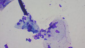 <img src="dog-ear-yeast-bacteria-microscope.jpg" alt="犬の耳の細菌や真菌（カビ）による炎症を顕微鏡で確認している検査画像">