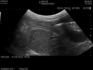 <img src="ultrasound-tumor.jpg" alt="犬の超音波（エコー）検査画像。体内にしこりが認められる様子">